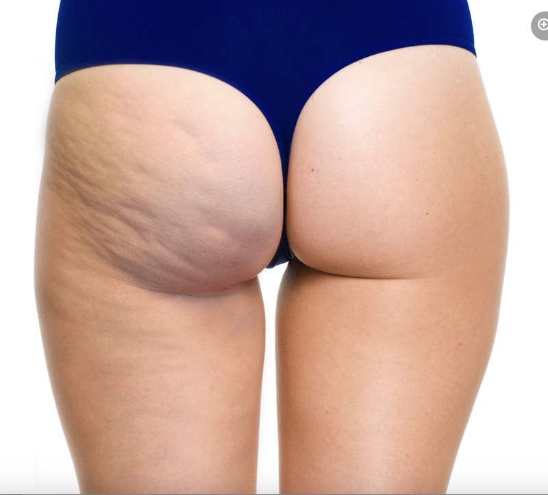 pliq® Leggings (S/M) – ANTI-CELLULITE Effect for Your Thighs, Legs & Buttocks! Scientifically Proven to Reduce the Appearance of Cellulite Simply by Wearing Them.