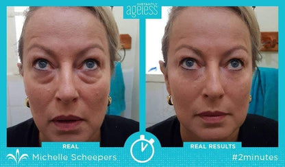 Instantly Ageless Facelift