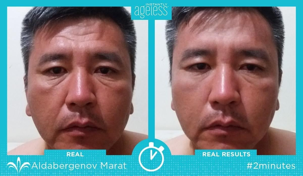 Instantly Ageless Facelift