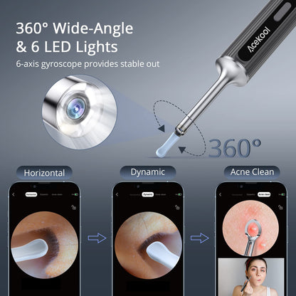 ACEKOOL Ear Wax Removal EV1 with 1080P HD Ear Camera Ear Cleaner