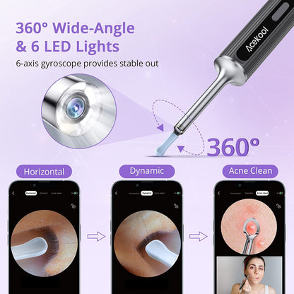 ACEKOOL Ear Wax Removal EV1 with 1080P HD Ear Camera Ear Cleaner